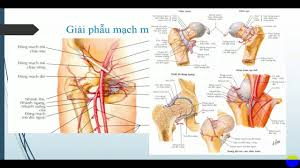 Ảnh 3 của Femoral Fracture